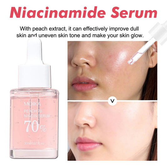 Sérum niacinamide anti-taches – Correcteur hyperpigmentation et pores dilatés - Lumiere